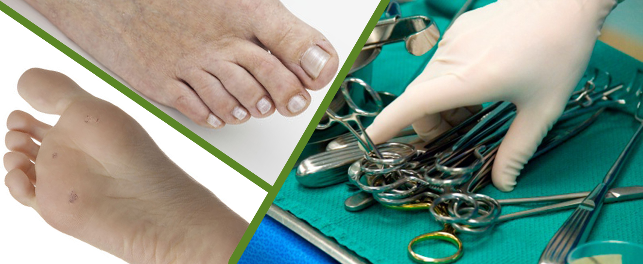 Ingrown Toenail Surgery - Buderim Podiatry, Sunshine Coast podiatrist, foot care